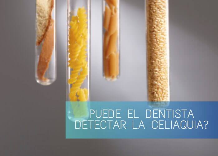 Nucia Clinic - Celiaquia