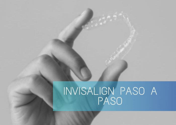 Nucia Clinic - Invisalign paso a paso