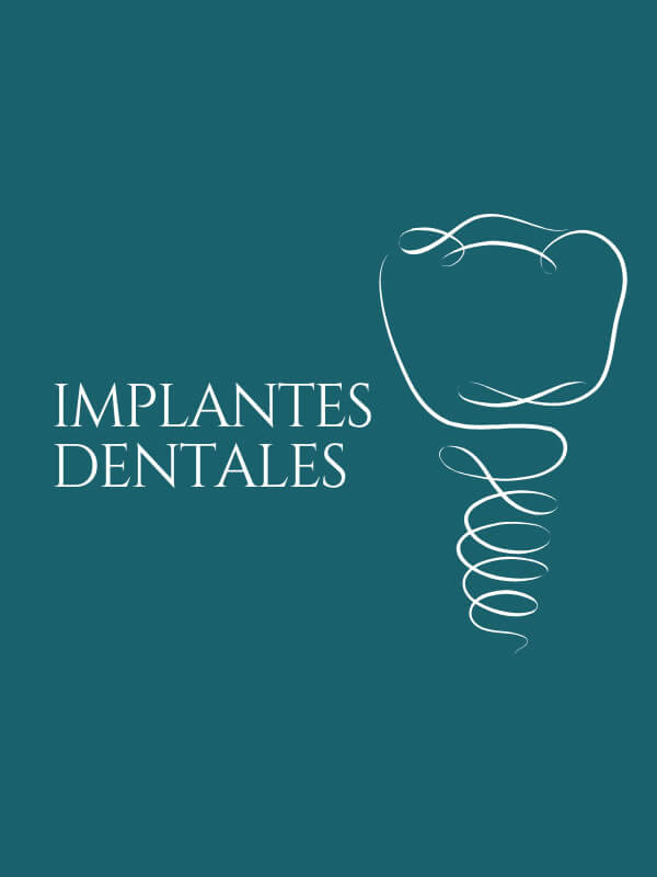 Nucia Clinic - Implantes Dentales